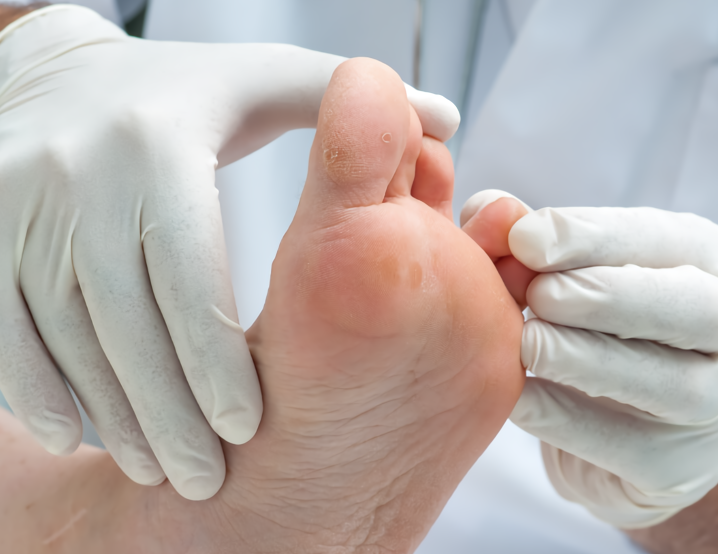 podologia_small_tta_1